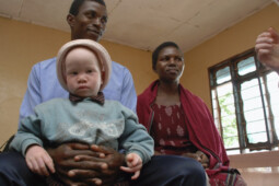 Kisah Pilu Orang Albino di Afrika, Diburu Demi Kekuatan Magis