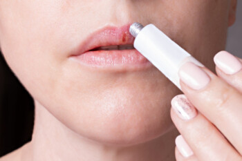 Mengatasi bibir pecah-pecah bisa dengan serum (ilustrasi/freepik))
