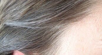 Rambut Beruban di Usia Masih Muda? Ini Cara Pencegahannya