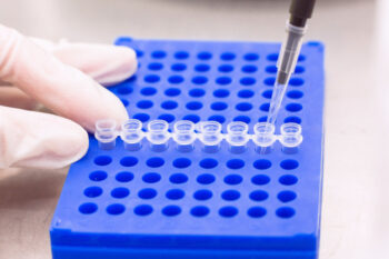 Tes PCR Tak Bisa Bedakan Virus Hidup atau Mati